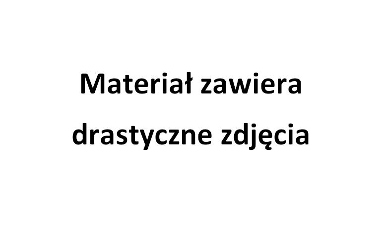 Policja prosi o pomoc w ustaleniu tożsamości denata - materiał zawiera drastyczne zdjęcia