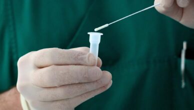 Punkt Diagnostyki Mobilnej w Tłuszczu