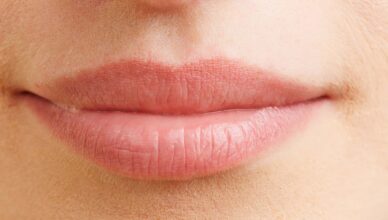 Lip flip – czym jest ten zabieg i dla kogo jest polecany?