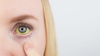 Zdążyć przed żółtym