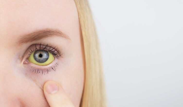 Zdążyć przed żółtym